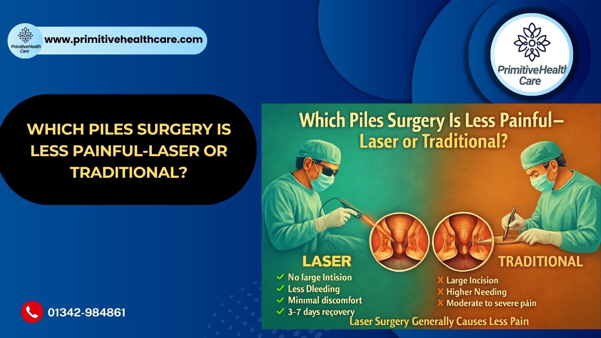 Which Piles Surgery Is Less Painful Laser or Traditional?